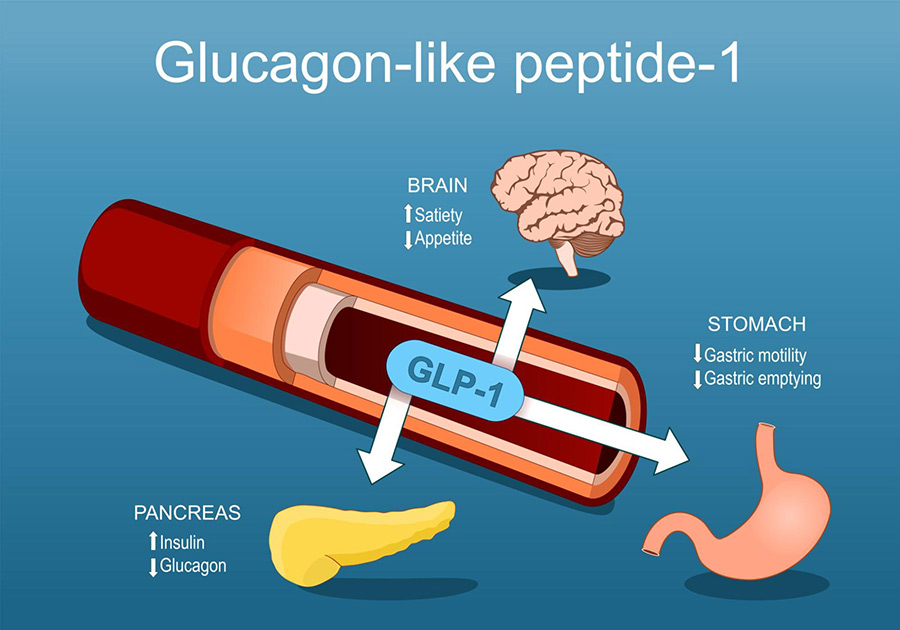 สูตร Feel Great เพิ่ม GLP-1 ธรรมชาติ แก้อาการเบาหวาน ลดน้ำตาลในเลือดสูง ลดภาวะดื้ออินซูลิน